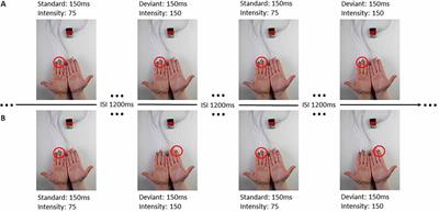 Different Patterns of Attention Modulation in Early N140 and Late P300 sERPs Following Ipsilateral vs. Contralateral Stimulation at the Fingers and Cheeks